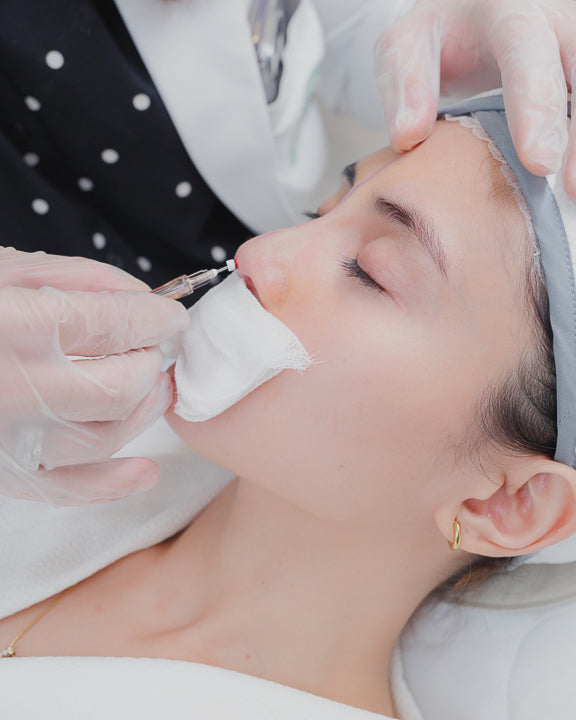 HIKO Non-Surgical Noselift (PDO Threads)