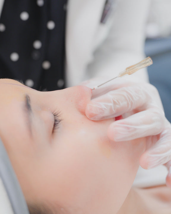 HIKO Non-Surgical Noselift (PDO Threads)