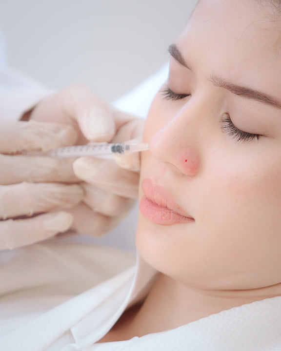 Alartox (Nasal Flaring)