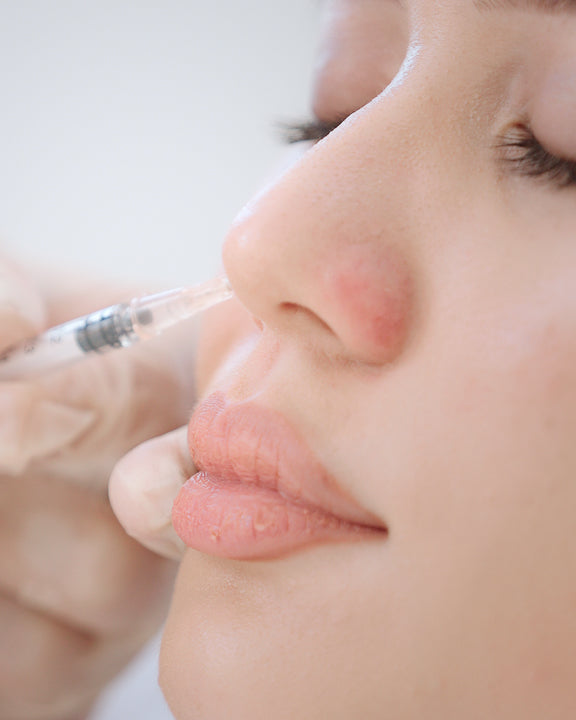 Alartox (Nasal Flaring)