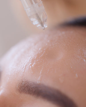 Jet Peel Facial