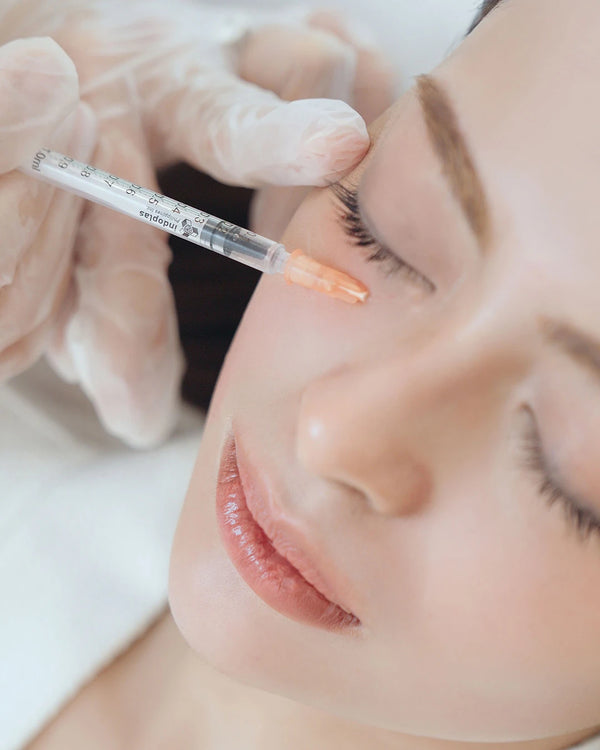 NCTF Undereye (3 Sessions)