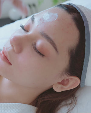 Acne Treatment Program