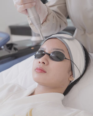 PicoLaser Glow + Hollywood Carbon Peel
