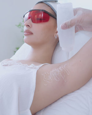 Diode Laser Hair Removal