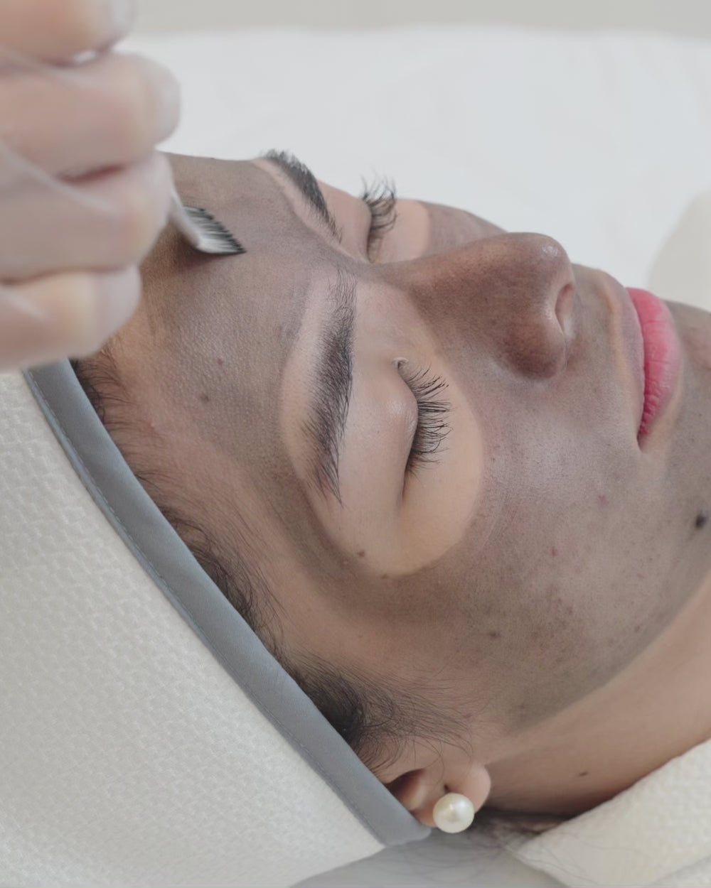 PicoLaser Glow + Hollywood Carbon Peel
