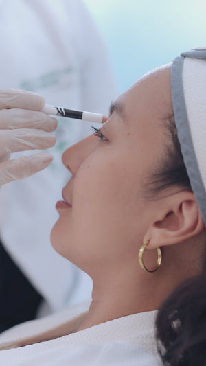 Botulinum Toxin (per unit)