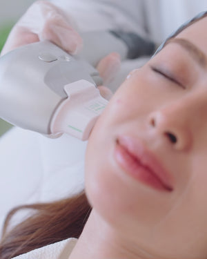 7D HIFU Ultralift