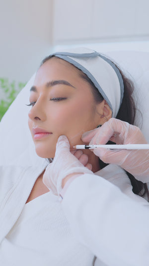 V-Contour Package