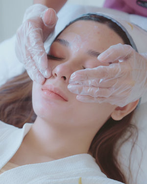 Acne Treatment Program