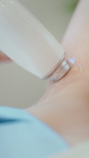 Diode Laser Hair Removal