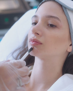 Lip Fillers